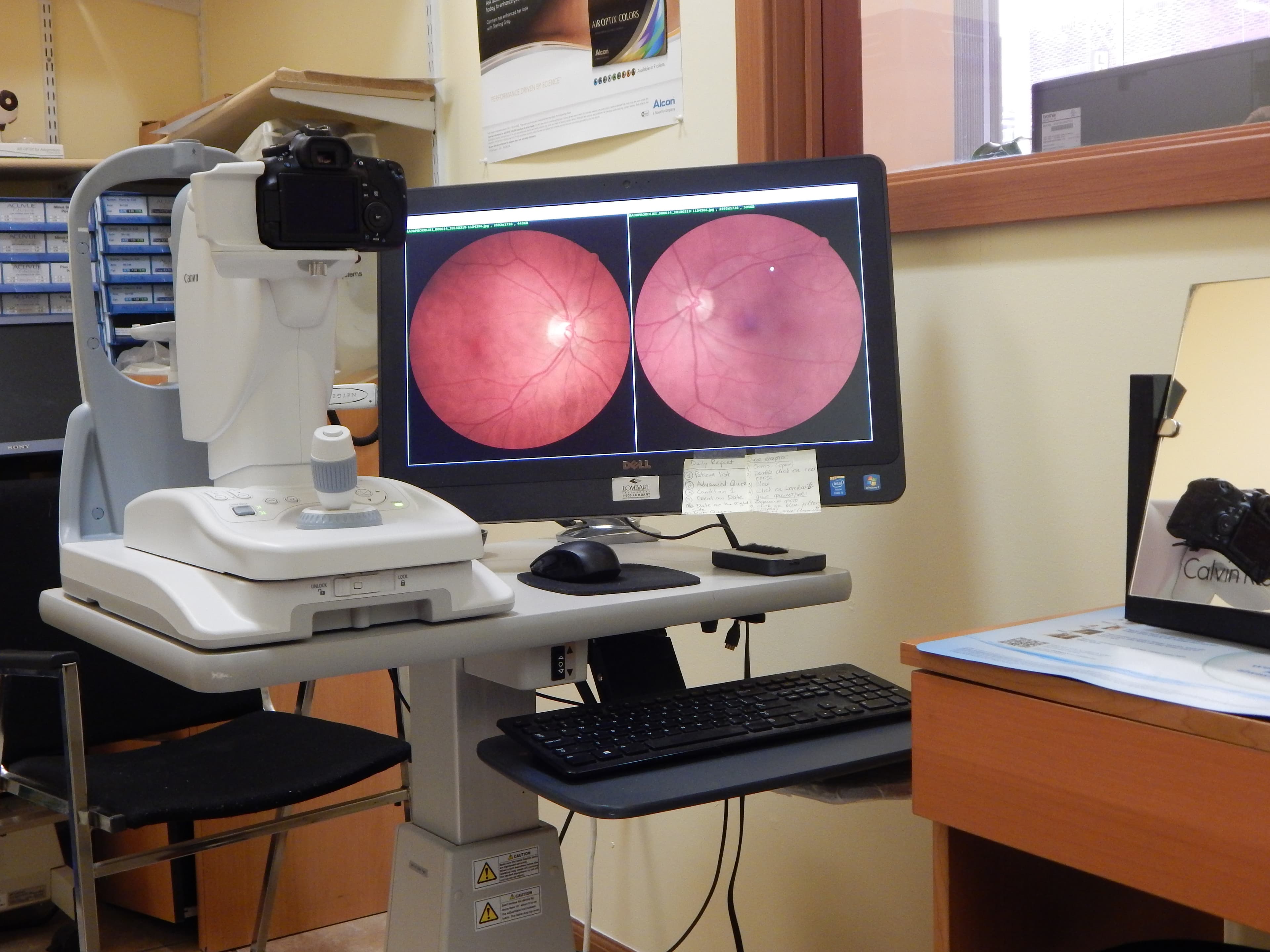 EYE EXAM EQUIPMENT